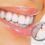 With medical aids no longer paying for cosmetic dental surgery and treatment, innovative new financing solutions have stepped up to the plate!