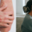 Alternative treatment can’t work when the body is at war with itself