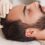 Effective Solutions for Hair Loss: Hair Transplant and Replacement Options