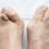 The Hidden Dangers of Wearing the Wrong Shoes: A Podiatrist’s Perspective