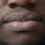 Dry Skin, Chapped Lips, and Nosebleeds: Dealing with Common Winter Ailments
