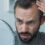 Hair Loss and Treatment Options That Actually Work