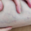 What You Should Know about Varicose Veins and How to Address Them
