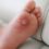 M Maddocks Inc Publishes New Foot Health Guides for Gym-Goers and Parents in Sandton